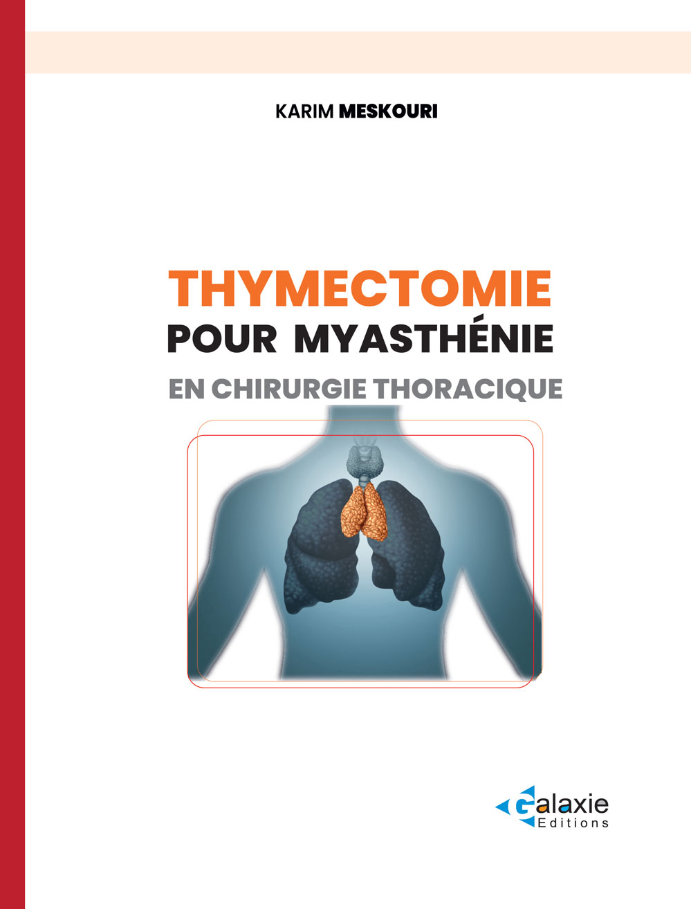 Thymectomie pour Myasthénie en Chirurgie ThoraciqueI
