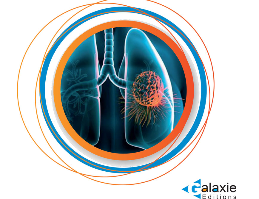 Epidémiologie et Diagnostic du CANCER BRONCHIQUE non à petites cellules