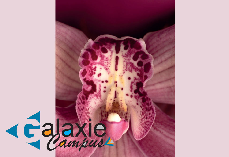 Le PROLAPSUS GÉNITAL Aspects Clinique et Pris en Charge Thérapeutique