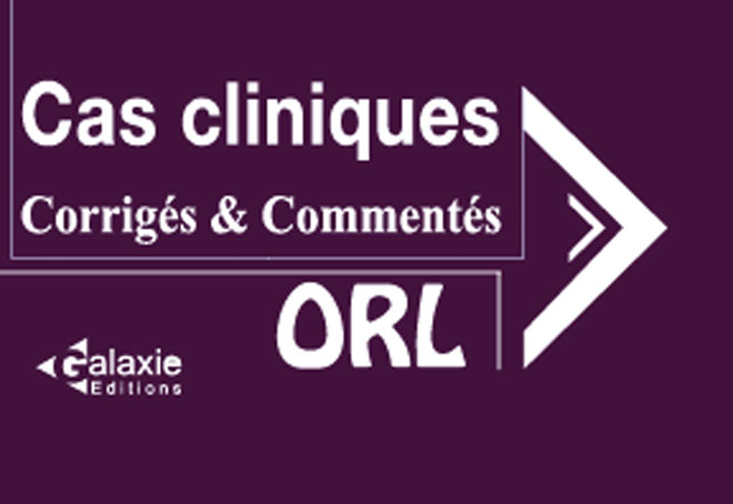 ORL QCM et Cas Cliniques Corrigé et Commentés