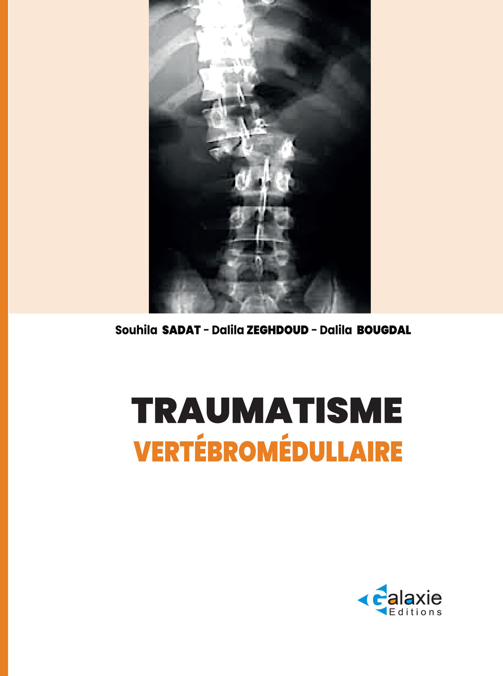 Traumatisme Vertébromédullaire