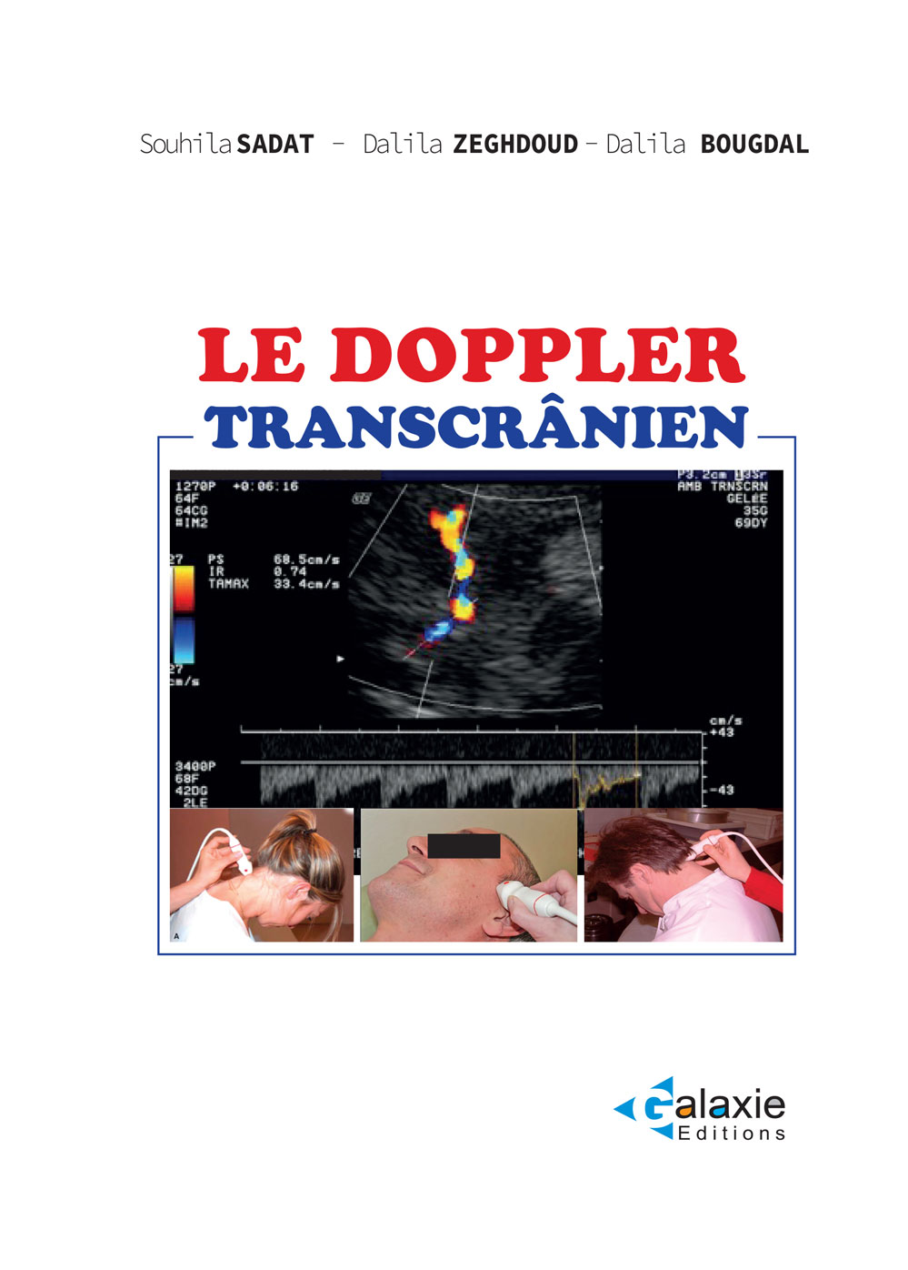 Le Doppler Transcrânier
