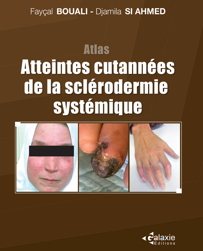 Atlas Atteintes Cutanées de la Sclérodermie Systémique