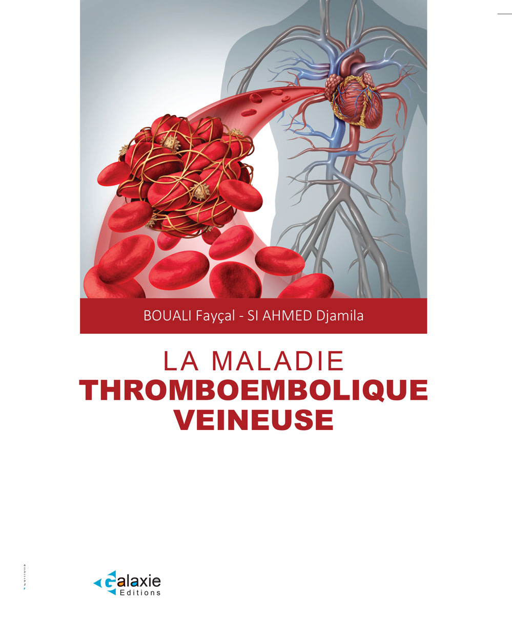 La Maladie THROMOEMBOLIQUE VEINEUSE