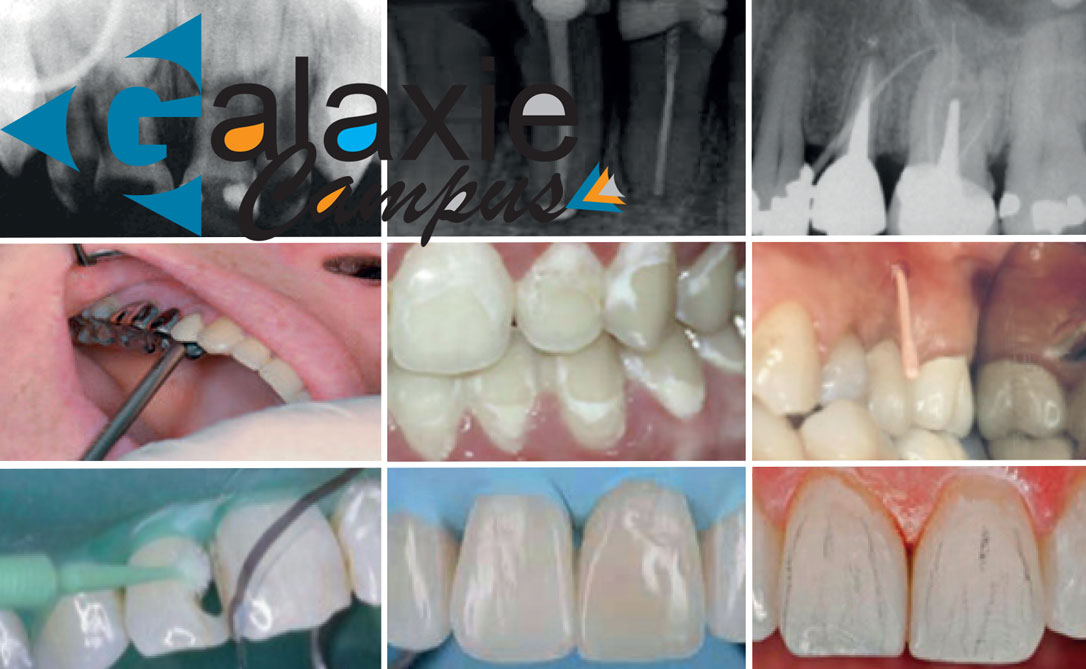 le Guide en ODONTOLOGIE CONSERVATRICE Volume 1