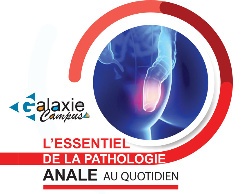 L'essentiel de la PATHOLOGIE ANALE au quotidien