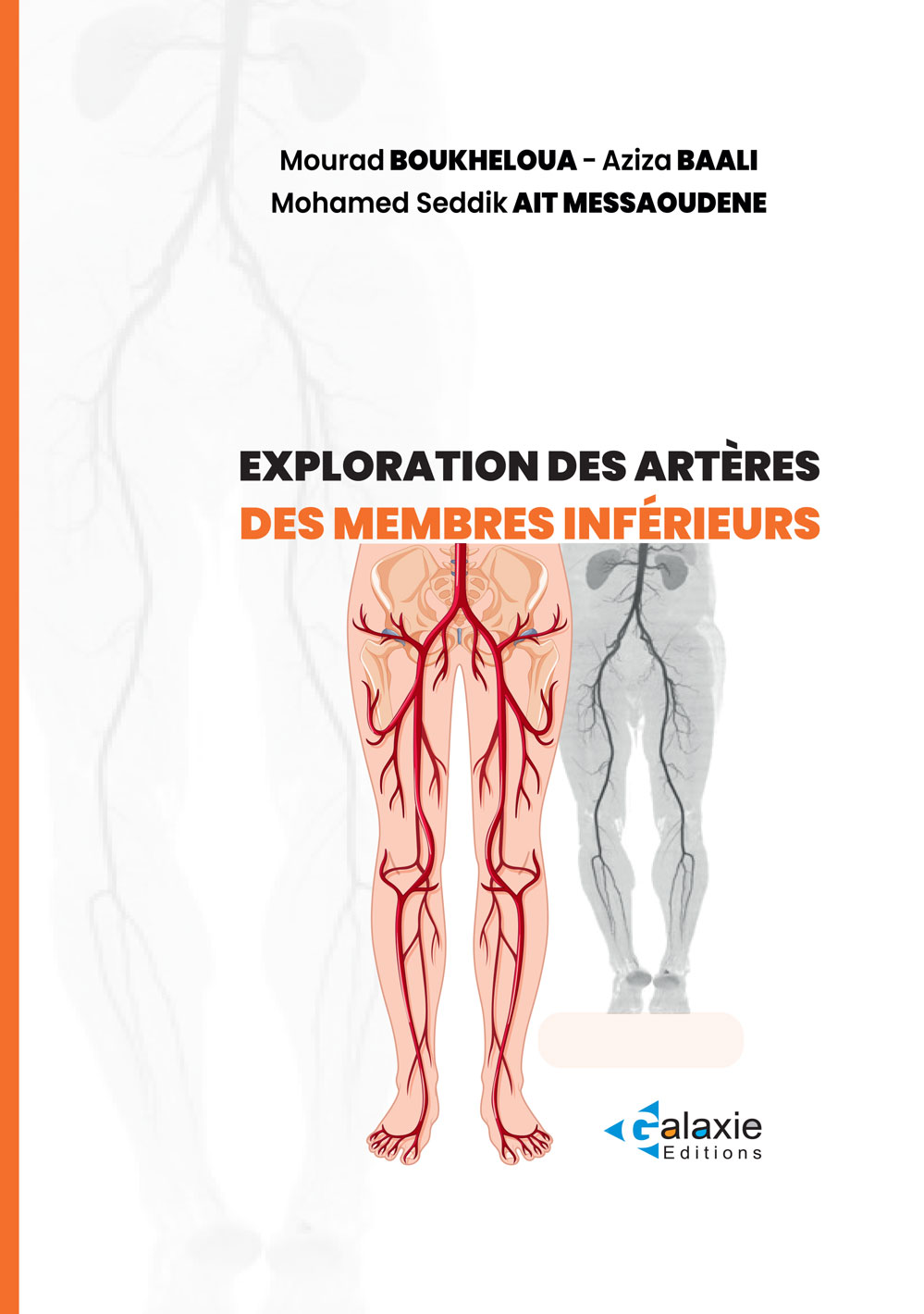 Exploration des Artères des MEMBRES INFÉRIEURS