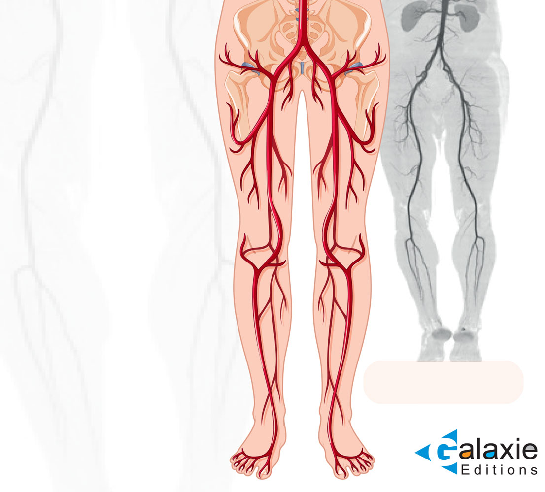 Exploration des Artères des MEMBRES INFÉRIEURS