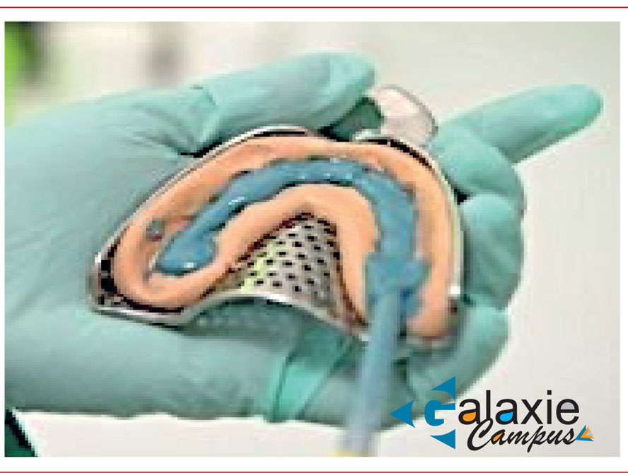 Biomatérieux et Restaurations Prothétiques