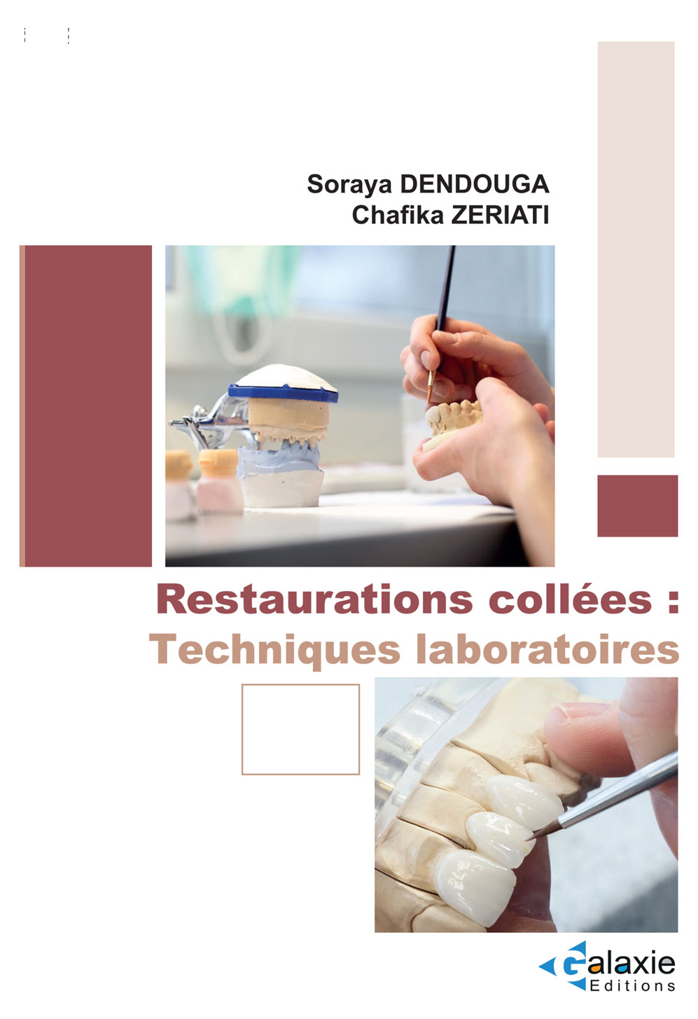 Restaurations Collées : Techniques Laboratoires