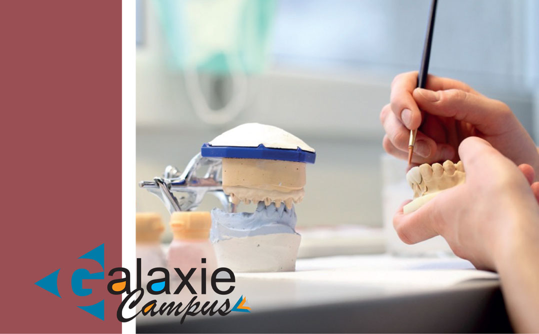 Restaurations Collées : Techniques Laboratoires