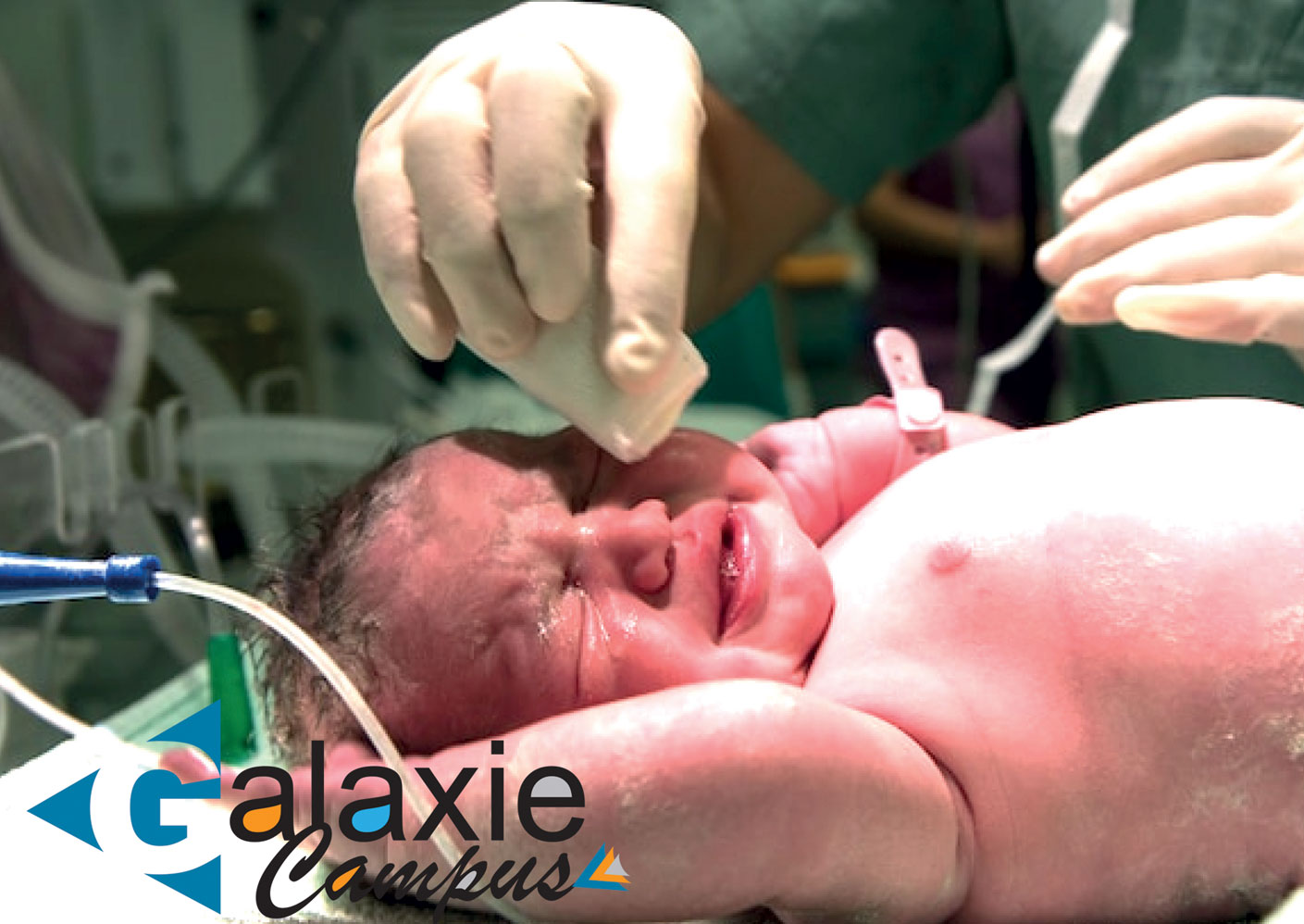 les CONVULSIONS NÉONATALES Prise en Charge