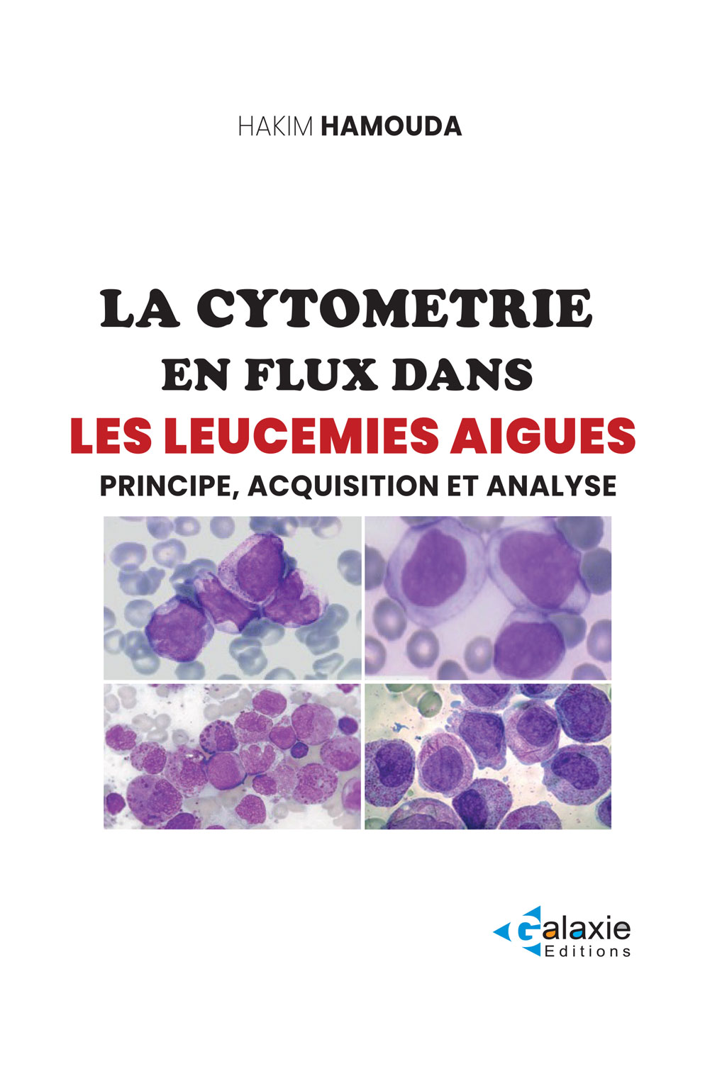 La cytométrie en flus dans les Leucémies Aigues