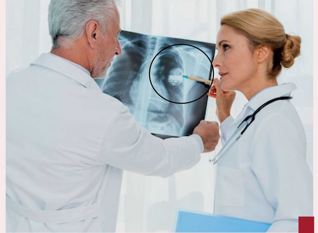 Éléments de Stimulation Cardiaque