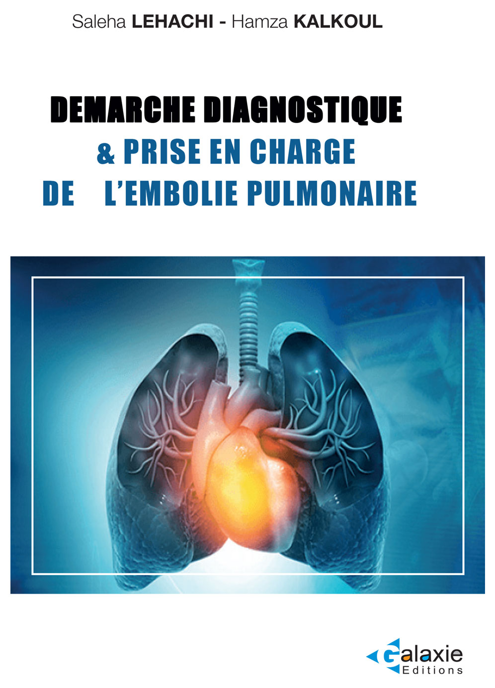Démarche Diagnostique et Prise en Charge de l'EMBLOIE PULMONAIRE