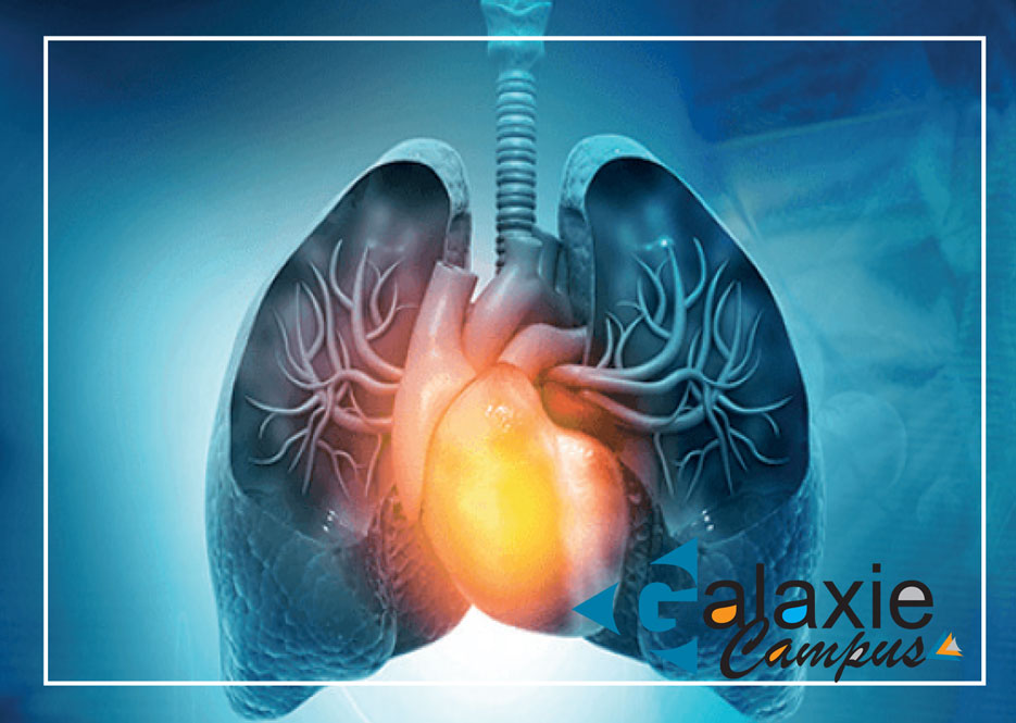 Démarche Diagnostique et Prise en Charge de l'EMBLOIE PULMONAIRE