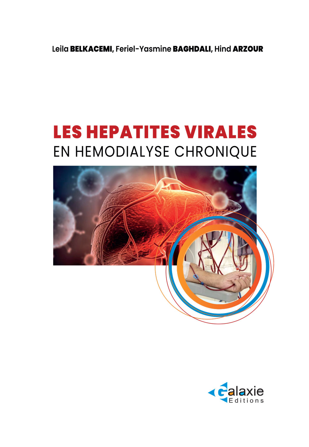 Les Hépatites Virales en HÉMODIALYSE CHRONIQUE