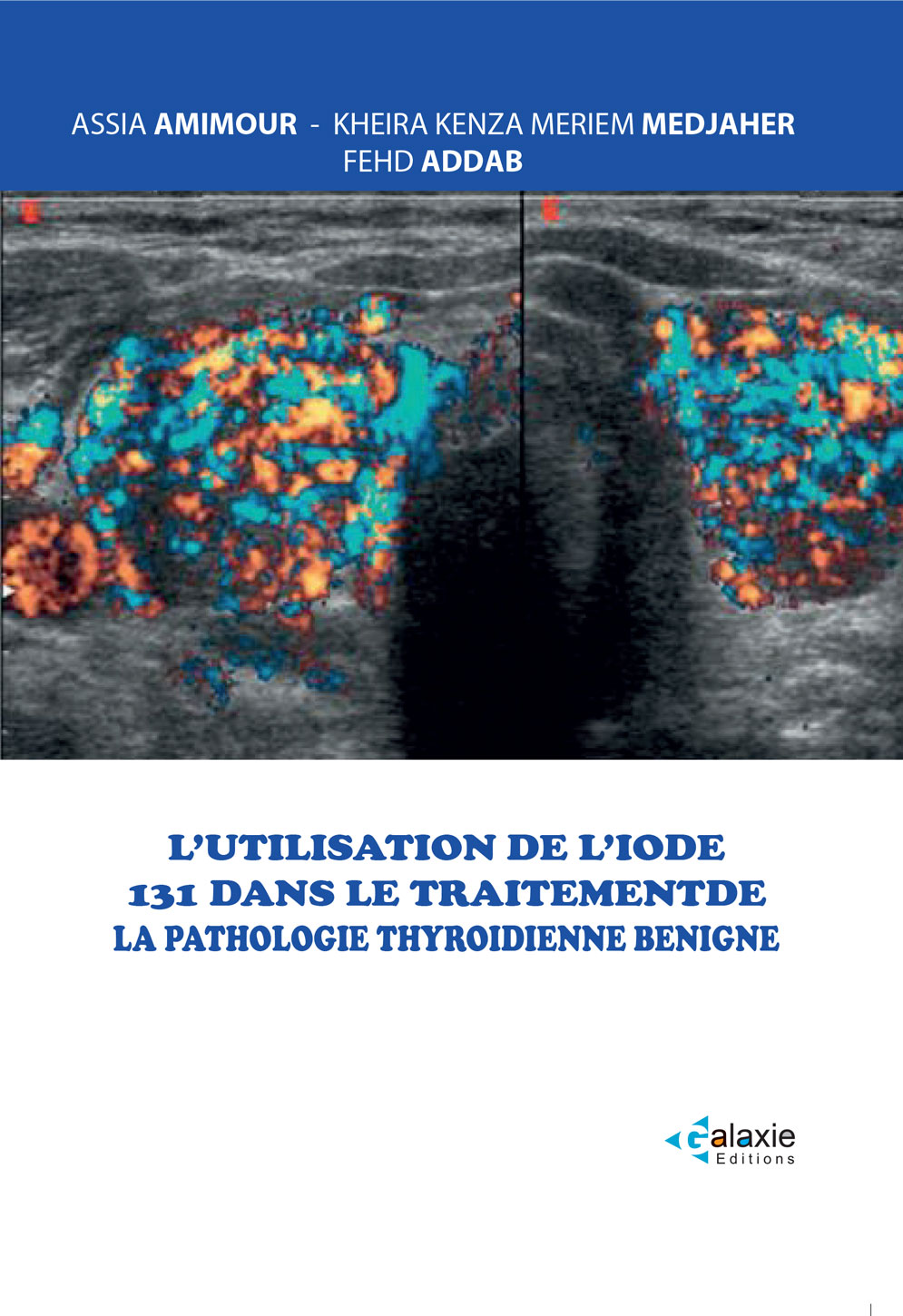 L'Utilisation de l'Iode 131 dans le traitement de la Pathologie Thyroïdienne Benigne