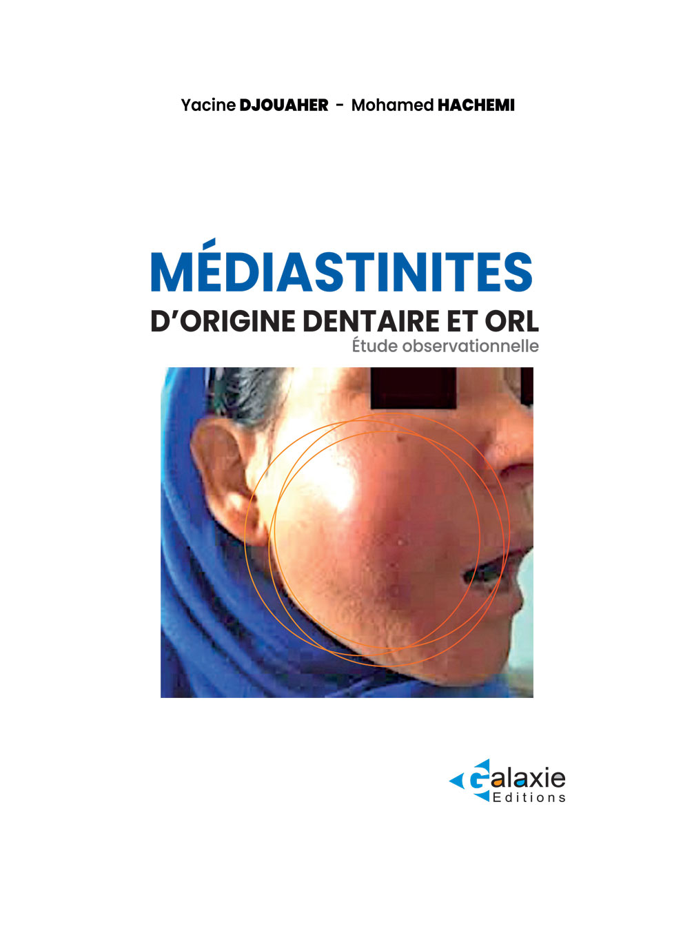 Médiastinites d'origine dentaire et ORL