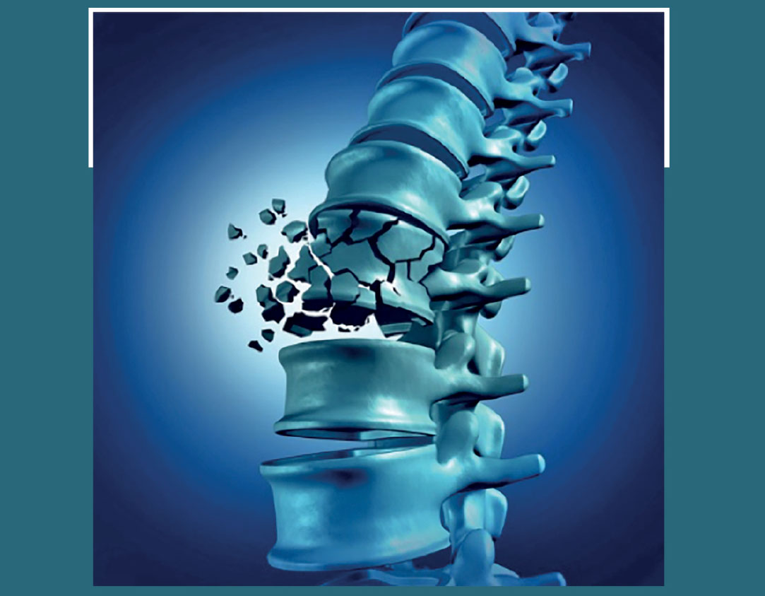 Le Blessé Medullaire  pendant les premiers mois