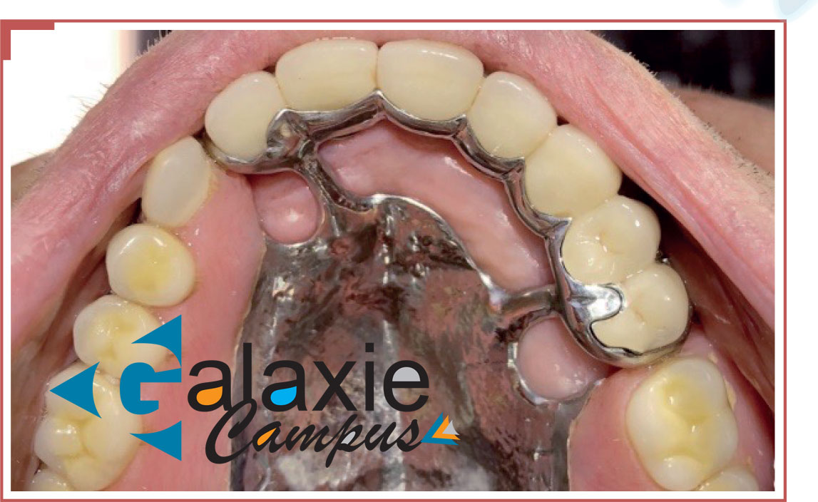 PARODONTOLOGIE ET PROTHESE un guide pour la santé bucco-dentaire