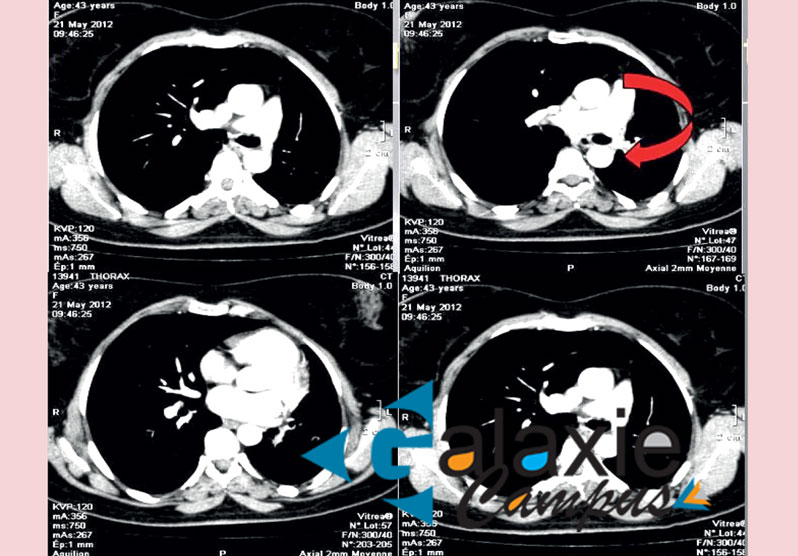 Dossiers Radiologiques Illustrés