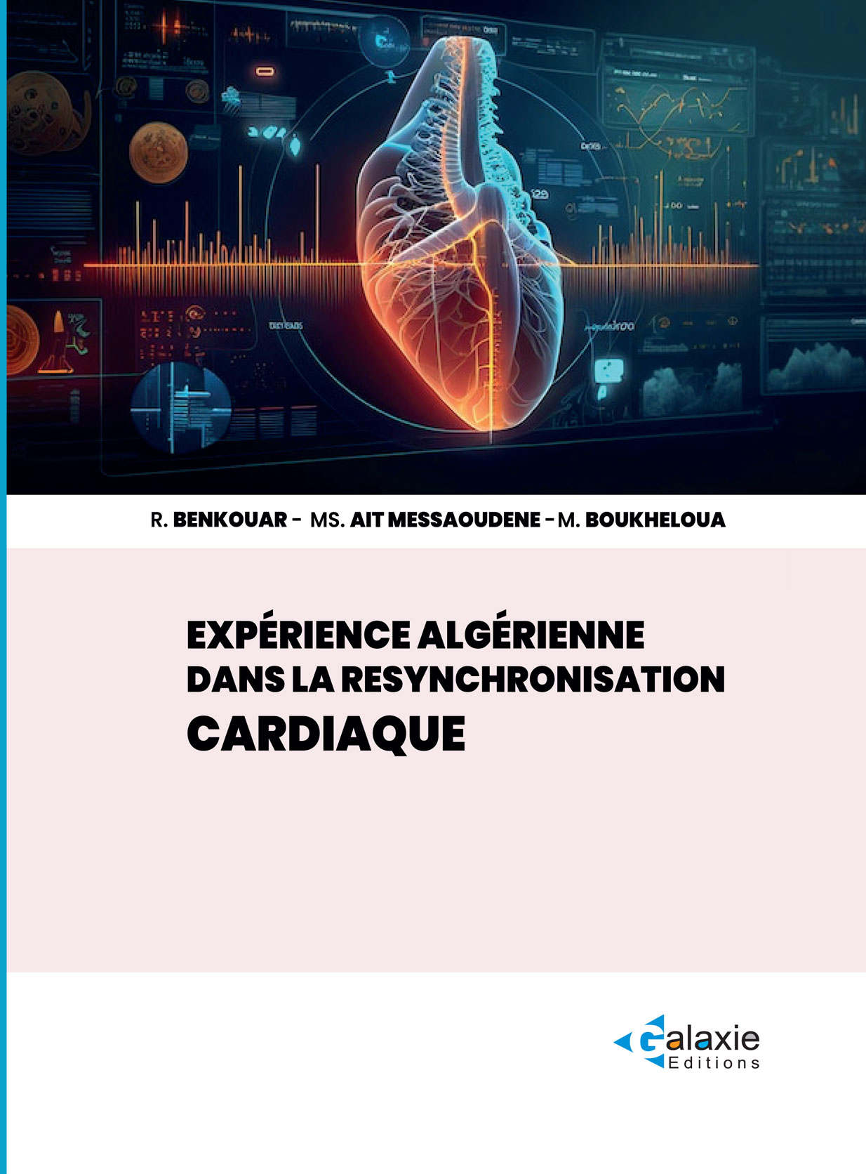Expérience Algérienne dans la Resynchronisation Cardiaque