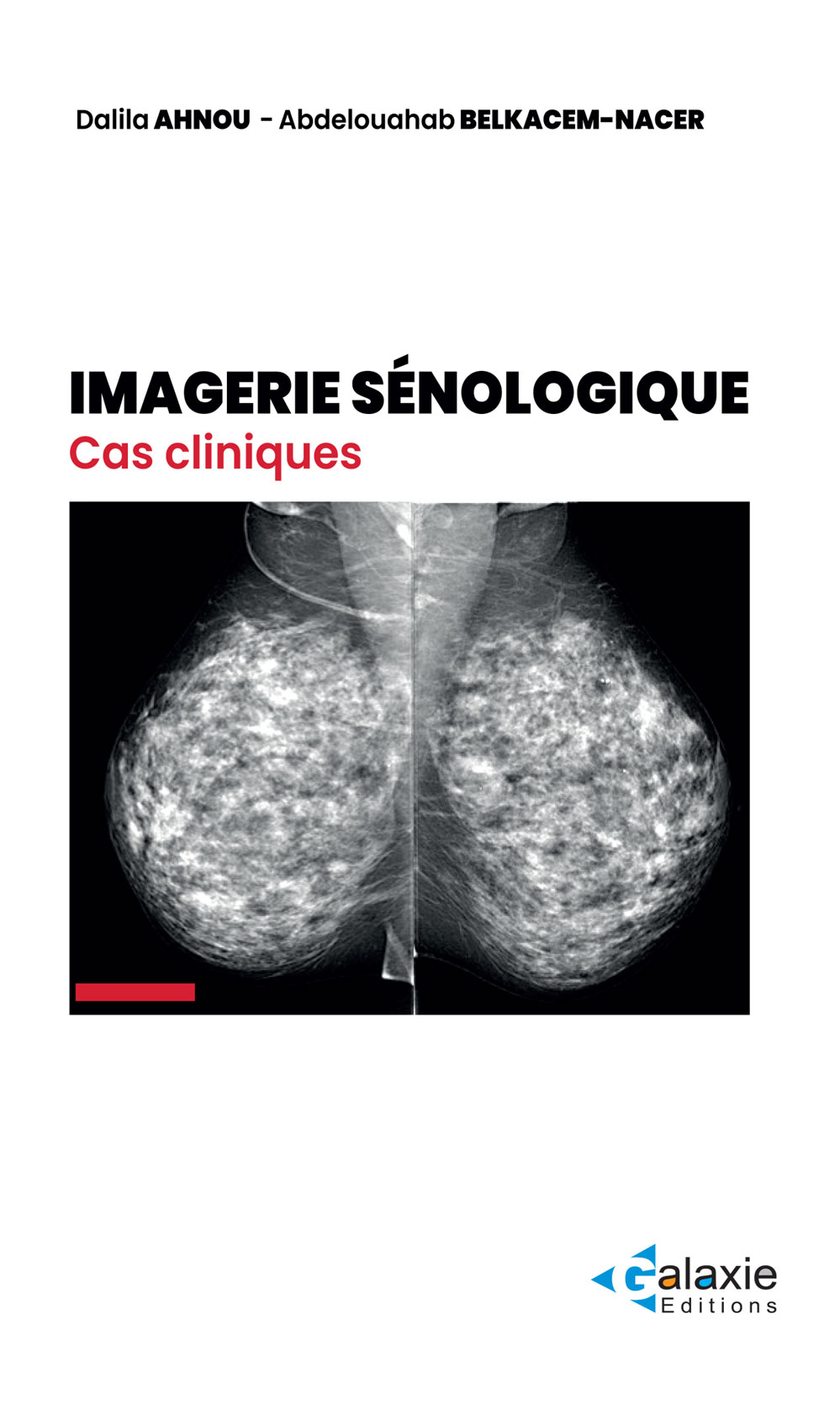IMAGERIE SÉNOLOGIQUE Cas Cliniques