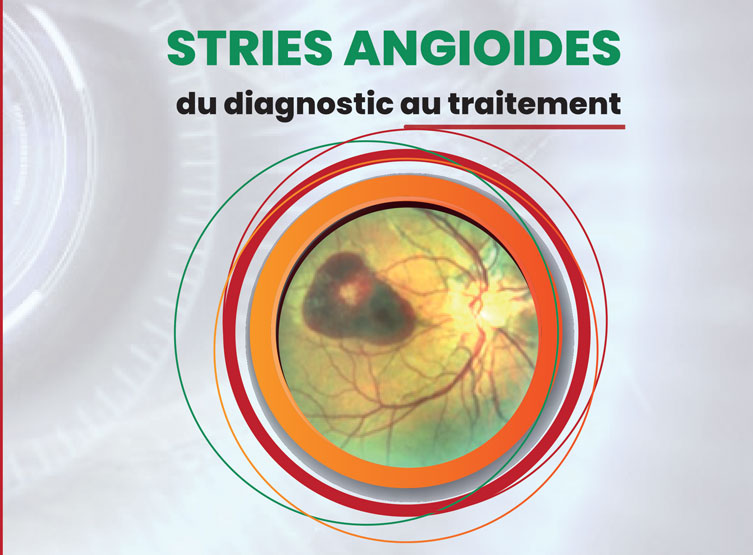 STRIES ANGIOÏDES du Diagnostic au Traitement