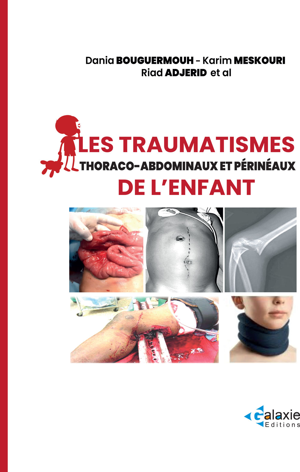 Les Traumatismes thoraco-abdominaux et périnéaux de l'ENFANT