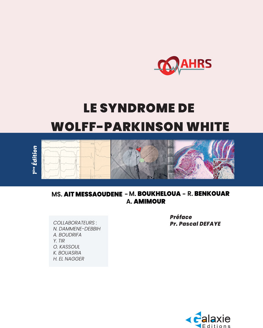 le Syndrôme de Wolff-Parkinson-White
